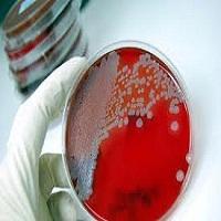 MODELO MATEMATICO DEL CRECIMIENTO BACTERIANO