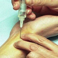 GASOMETRÍA ARTERIAL